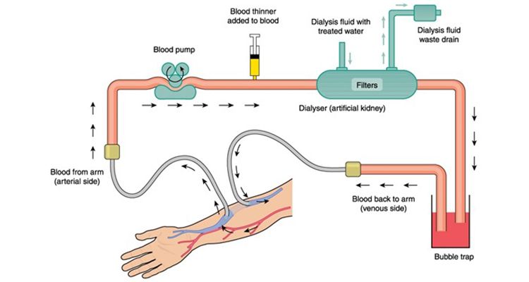 Dialysis Specialist in Noida