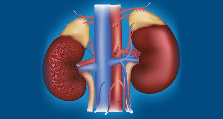 Renal Specialist in Noida