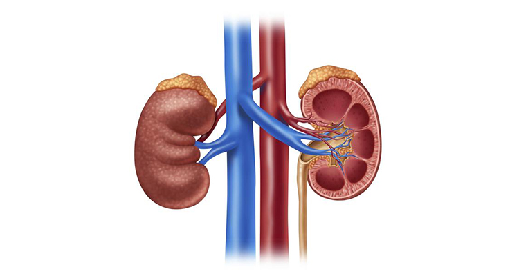 kidney treatment in noida