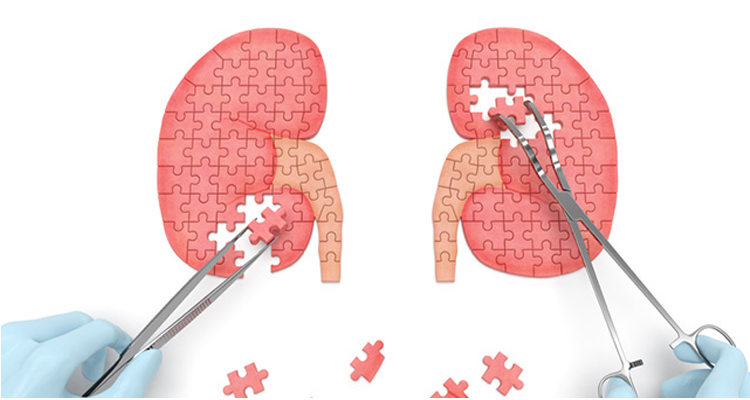 Renal Replacement therapy