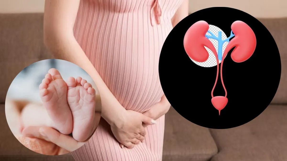 Kidney Diseases Treatment in Pregnancy Noida